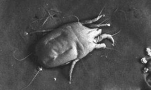 dust-mite-2